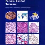 خرید و دانلود نسخه کامل کتاب Female Genital Tumours: WHO Classification of Tumours
