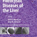 خرید و دانلود نسخه کامل کتاب Fibrocystic Diseases of the Liver