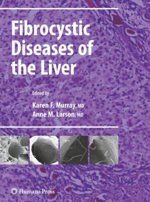خرید و دانلود نسخه کامل کتاب Fibrocystic Diseases of the Liver