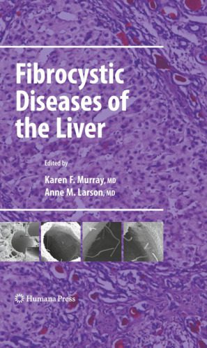 خرید و دانلود نسخه کامل کتاب Fibrocystic Diseases of the Liver_68b98dc886b2b.jpeg خرید و دانلود نسخه کامل کتاب Fibrocystic Diseases of the Liver