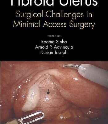 خرید و دانلود نسخه کامل کتاب Fibroid Uterus: Surgical Challenges in Minimal Access Surgery