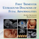 خرید و دانلود نسخه کامل کتاب First Trimester Ultrasound Diagnosis of Fetal Abnormalities