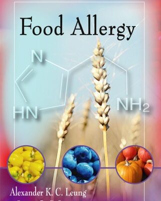 خرید و دانلود نسخه کامل کتاب Food Allergy (Allergies and Infectious Diseases)
