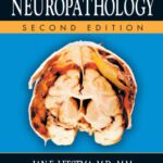 خرید و دانلود نسخه کامل کتاب Forensic neuropathology