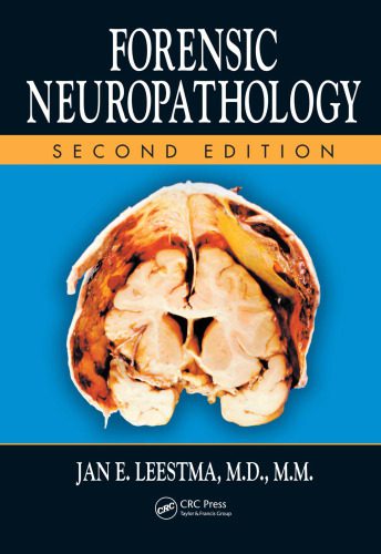 خرید و دانلود نسخه کامل کتاب Forensic neuropathology_68bbed8e29e59.jpeg خرید و دانلود نسخه کامل کتاب Forensic neuropathology