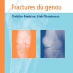 خرید و دانلود نسخه کامل کتاب Fractures du genou (Approche pratique en orthopedie-traumatologie)