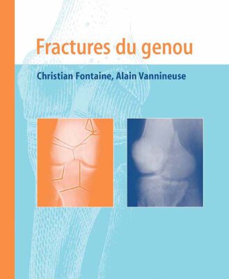 خرید و دانلود نسخه کامل کتاب Fractures du genou (Approche pratique en orthopedie-traumatologie)