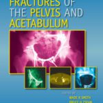 خرید و دانلود نسخه کامل کتاب Fractures of the Pelvis and Acetabulum