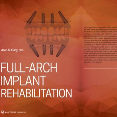 خرید و دانلود نسخه کامل کتاب Full-Arch Implant Rehabilitation