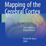 خرید و دانلود نسخه کامل کتاب Functional Mapping of the Cerebral Cortex: Safe Surgery in Eloquent Brain