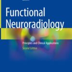 خرید و دانلود نسخه کامل کتاب Functional Neuroradiology: Principles and Clinical Applications