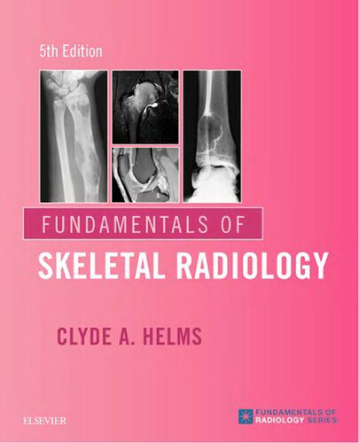 خرید و دانلود نسخه کامل کتاب Fundamentals of Skeletal Radiology_68bc52c463c42.jpeg خرید و دانلود نسخه کامل کتاب Fundamentals of Skeletal Radiology