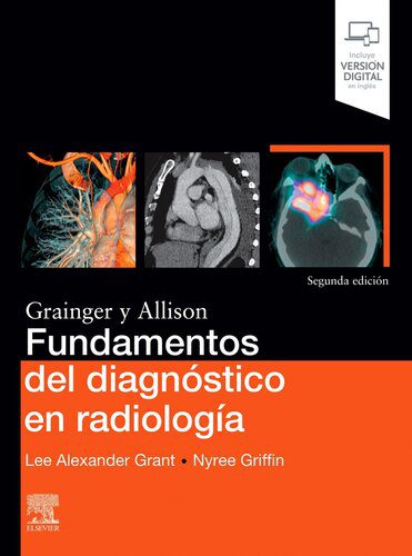 خرید و دانلود نسخه کامل کتاب Fundamentos del diagnóstico en radiología_68bad1e7c7471.jpeg خرید و دانلود نسخه کامل کتاب Fundamentos del diagnóstico en radiología