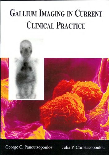 خرید و دانلود نسخه کامل کتاب Gallium Imaging In Current Clinical Practice_68bae82b44f97.jpeg خرید و دانلود نسخه کامل کتاب Gallium Imaging In Current Clinical Practice