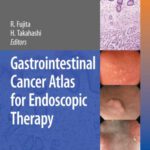خرید و دانلود نسخه کامل کتاب Gastrointestinal Cancer Atlas for Endoscopic Therapy