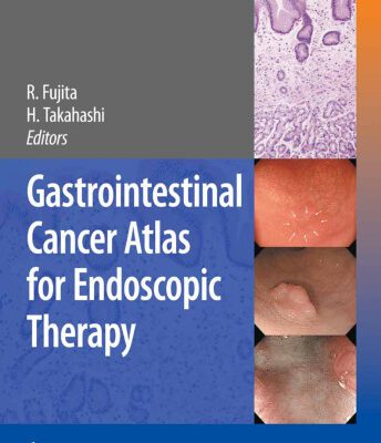 خرید و دانلود نسخه کامل کتاب Gastrointestinal Cancer Atlas for Endoscopic Therapy