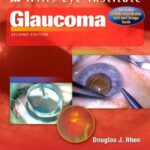 خرید و دانلود نسخه کامل کتاب Glaucoma
