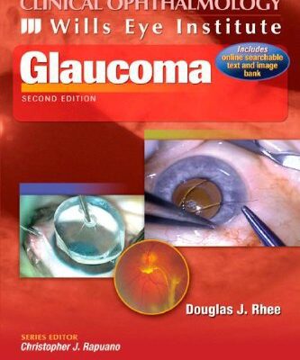 خرید و دانلود نسخه کامل کتاب Glaucoma