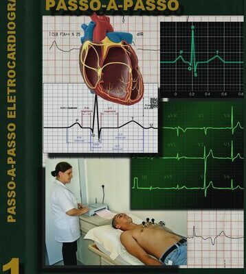 خرید و دانلود نسخه کامل کتاب Guia de Eletrocardiograma: Passo-a-passo (MedBook)