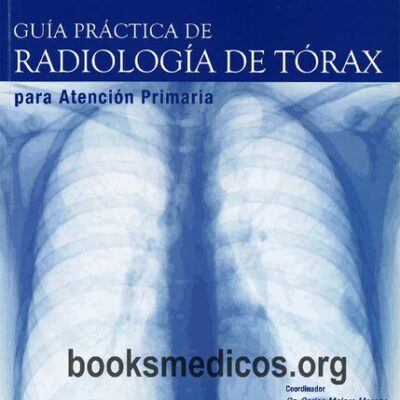 خرید و دانلود نسخه کامل کتاب Guía Práctica de Radiología de Tórax para atención primaria