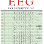 خرید و دانلود نسخه کامل کتاب Handbook of EEG Interpretation