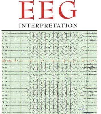 خرید و دانلود نسخه کامل کتاب Handbook of EEG Interpretation