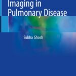 خرید و دانلود نسخه کامل کتاب Handbook of Imaging in Pulmonary Disease