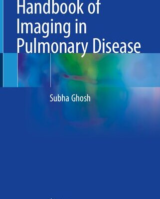 خرید و دانلود نسخه کامل کتاب Handbook of Imaging in Pulmonary Disease