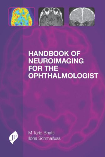 خرید و دانلود نسخه کامل کتاب Handbook of Neuroimaging for the Ophthalmologist_68bbce9b7bfea.jpeg خرید و دانلود نسخه کامل کتاب Handbook of Neuroimaging for the Ophthalmologist