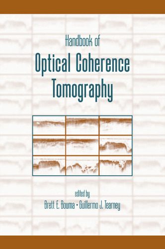 خرید و دانلود نسخه کامل کتاب Handbook of Optical Coherence Tomography_68d4d34d17639.jpeg خرید و دانلود نسخه کامل کتاب Handbook of Optical Coherence Tomography