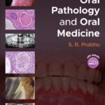 خرید و دانلود نسخه کامل کتاب Handbook of Oral Pathology and Oral Medicine