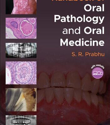 خرید و دانلود نسخه کامل کتاب Handbook of Oral Pathology and Oral Medicine