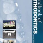 خرید و دانلود نسخه کامل کتاب Handbook of Orthodontics