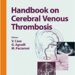 خرید و دانلود نسخه کامل کتاب Handbook on Cerebral Venous Thrombosis (Frontiers of Neurology and Neuroscience)
