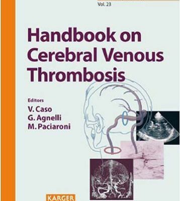 خرید و دانلود نسخه کامل کتاب Handbook on Cerebral Venous Thrombosis (Frontiers of Neurology and Neuroscience)