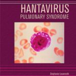 خرید و دانلود نسخه کامل کتاب Hantavirus Pulmonary Syndrome (Deadly Diseases and Epidemics)