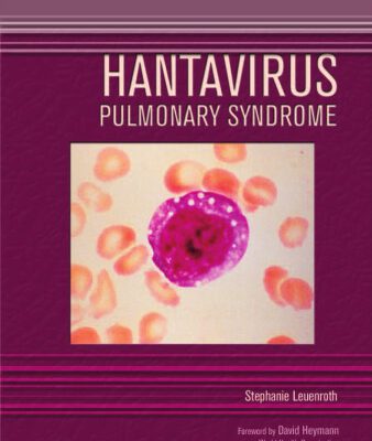خرید و دانلود نسخه کامل کتاب Hantavirus Pulmonary Syndrome (Deadly Diseases and Epidemics)