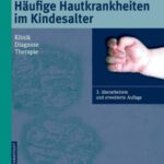خرید و دانلود نسخه کامل کتاب Häufige Hautkrankheiten im Kindesalter: Klinik – Diagnose – Therapie