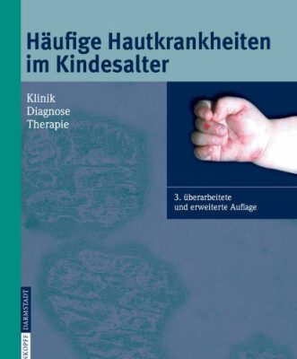 خرید و دانلود نسخه کامل کتاب Häufige Hautkrankheiten im Kindesalter: Klinik – Diagnose – Therapie