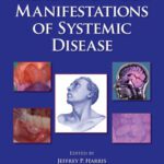 خرید و دانلود نسخه کامل کتاب Head and Neck Manifestations of Systemic Disease