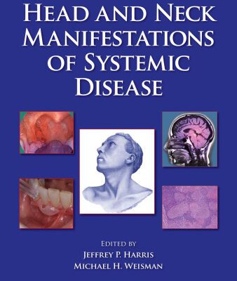 خرید و دانلود نسخه کامل کتاب Head and Neck Manifestations of Systemic Disease