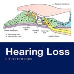 خرید و دانلود نسخه کامل کتاب Hearing Loss