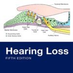 خرید و دانلود نسخه کامل کتاب Hearing Loss
