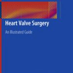 خرید و دانلود نسخه کامل کتاب Heart Valve Surgery: An Illustrated Guide