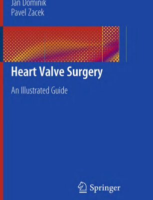 خرید و دانلود نسخه کامل کتاب Heart Valve Surgery: An Illustrated Guide