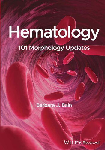 خرید و دانلود نسخه کامل کتاب Hematology: 101 Morphology Updates_68b605c2b9066.jpeg خرید و دانلود نسخه کامل کتاب Hematology: 101 Morphology Updates
