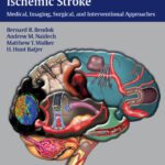 خرید و دانلود نسخه کامل کتاب Hemorrhagic and Ischemic Stroke: Medical, Imaging, Surgical and Interventional Approaches