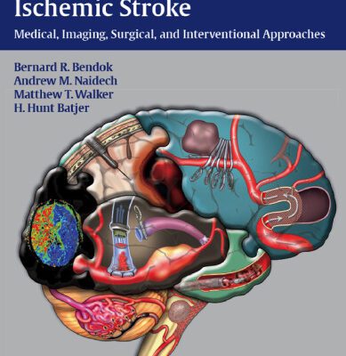 خرید و دانلود نسخه کامل کتاب Hemorrhagic and Ischemic Stroke: Medical, Imaging, Surgical and Interventional  Approaches