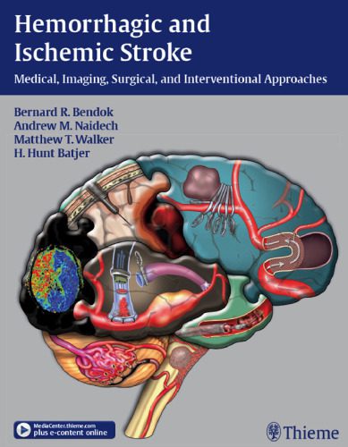 خرید و دانلود نسخه کامل کتاب Hemorrhagic and Ischemic Stroke: Medical, Imaging, Surgical and Interventional Approaches_68bb537f61e42.jpeg خرید و دانلود نسخه کامل کتاب Hemorrhagic and Ischemic Stroke: Medical, Imaging, Surgical and Interventional Approaches