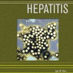 خرید و دانلود نسخه کامل کتاب Hepatitis (Deadly Diseases and Epidemics)